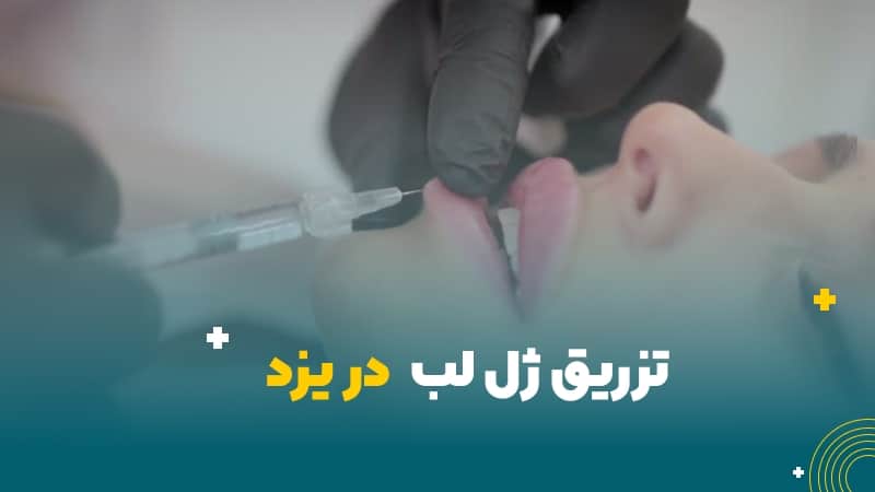 تزریق ژل لب در یزد