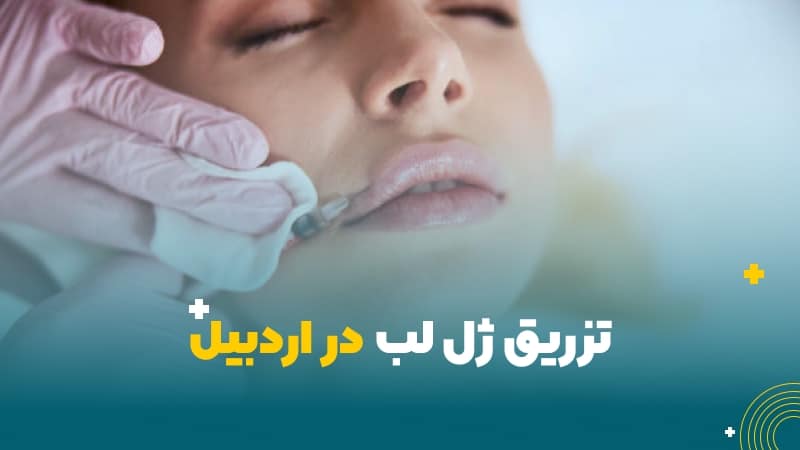 تزریق ژل لب در اردبیل