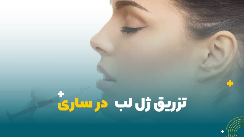 تزریق ژل لب در ساری