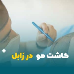 کاشت مو در زابل