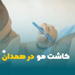 کاشت مو در همدان