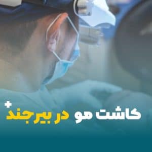 کاشت مو در بیرجند