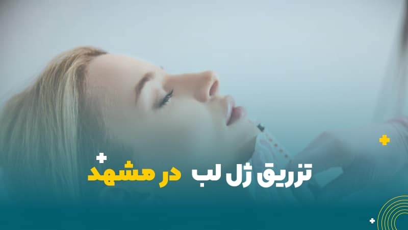 تزریق ژل لب در مشهد