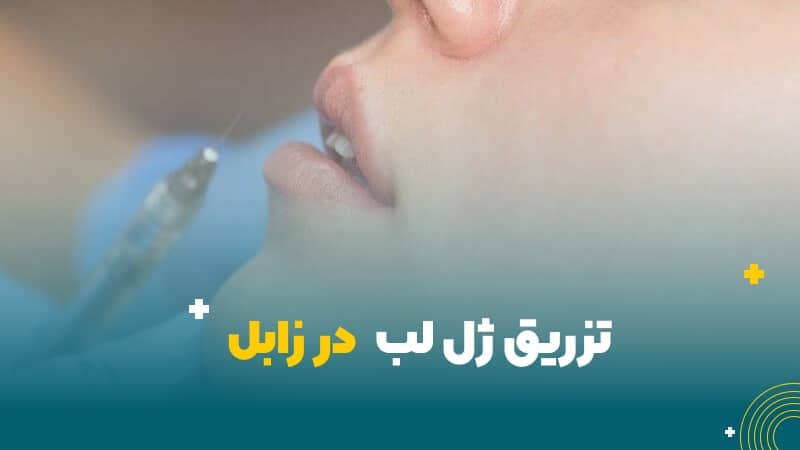 تزریق ژل لب در زابل