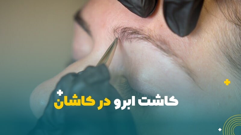 کاشت ابرو در کاشان